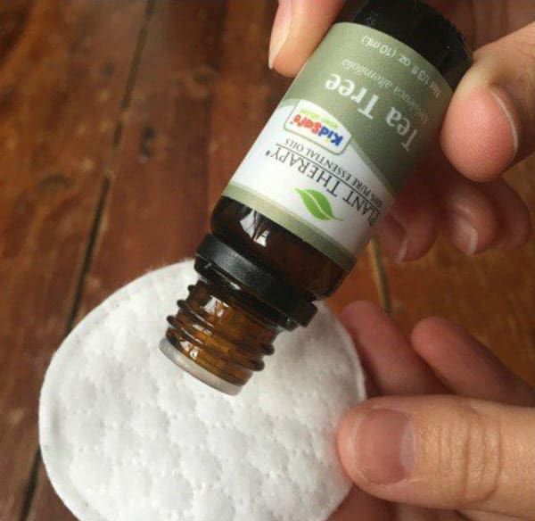 tea tree oil for bed bug bites