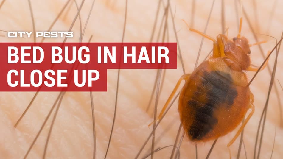 close up picture of a bed bug in hair